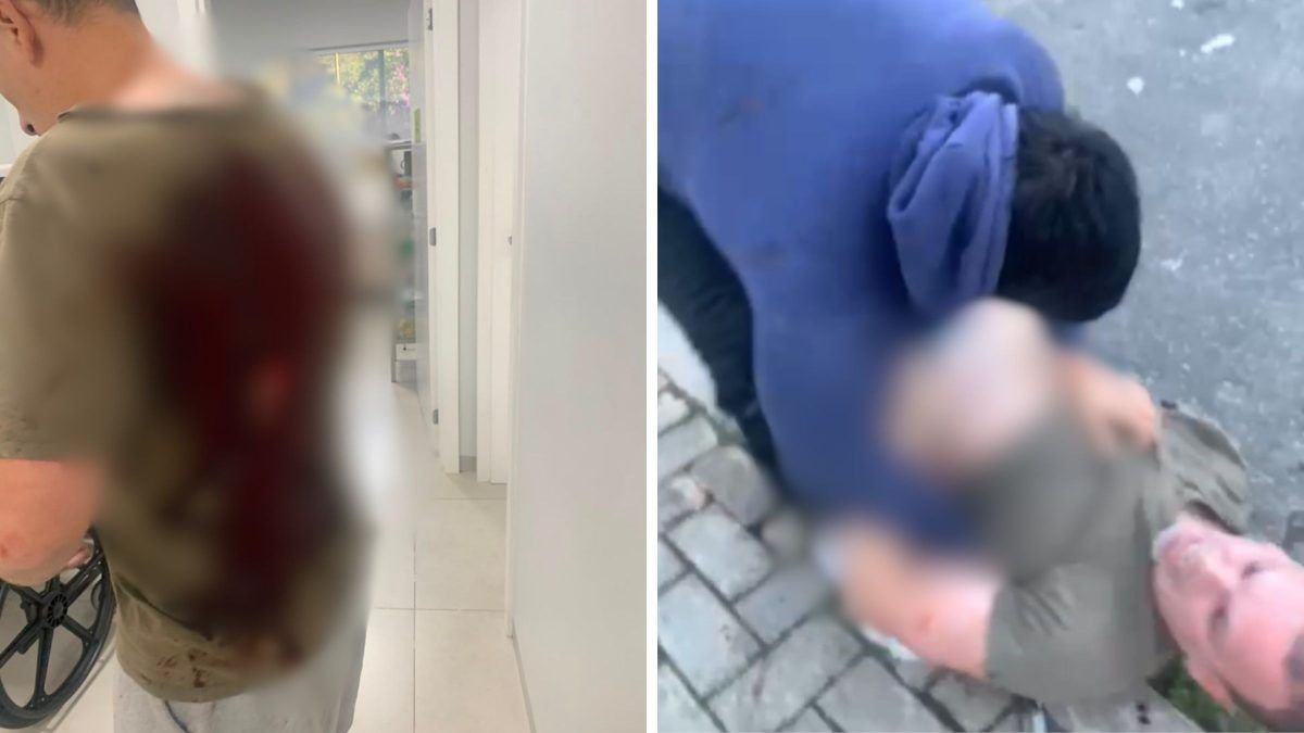Homem é preso após esfaquear jornalista que defendeu esposa de ataque com ofensas racistas em SC