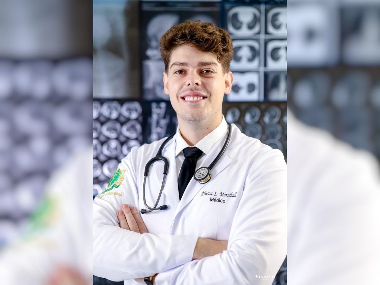 Julho Amarelo: Médico de Descanso alerta para o perigo das hepatites virais
