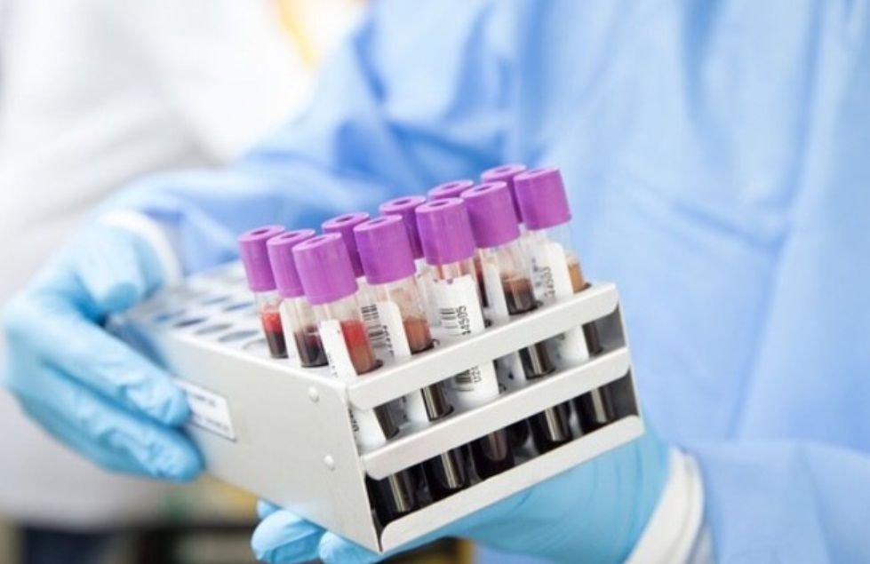 Justiça de SC disponibiliza 1,6 mil kits para coleta de DNA em audiências