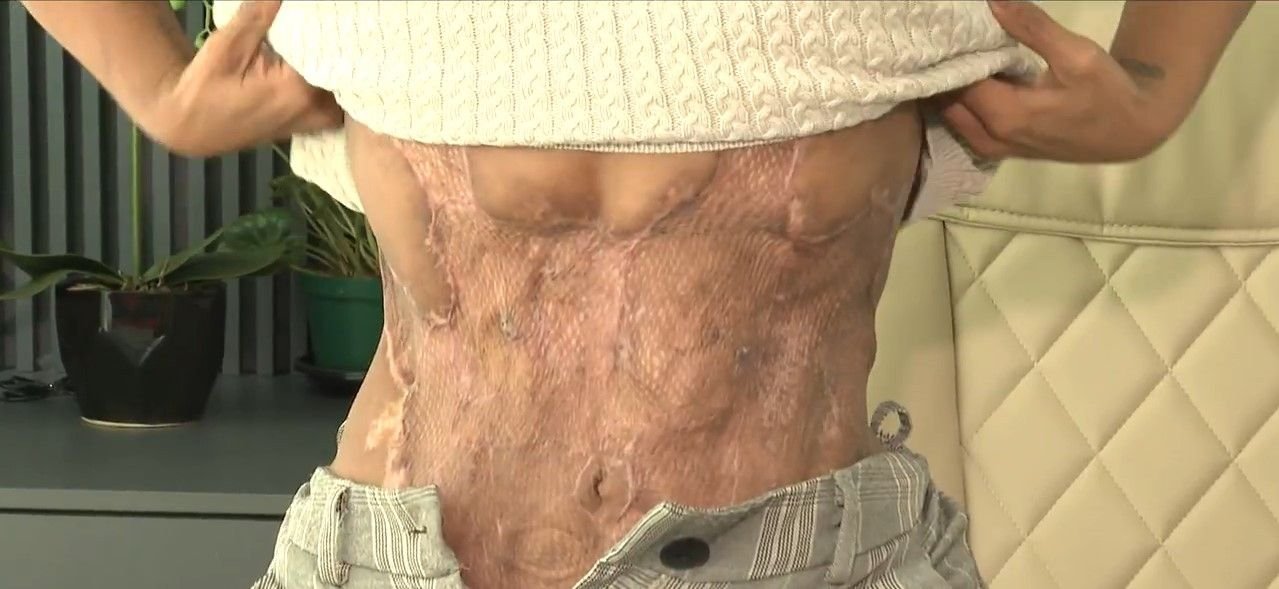 Justiça mantém pena de prisão de médico por lesão corporal em paciente em SC