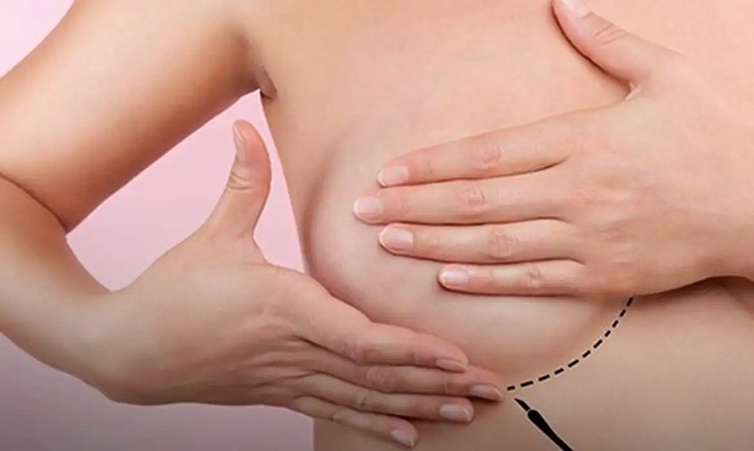 Outubro Rosa: UCEFF realiza palestra de conscientização, informação e cuidado da mulher